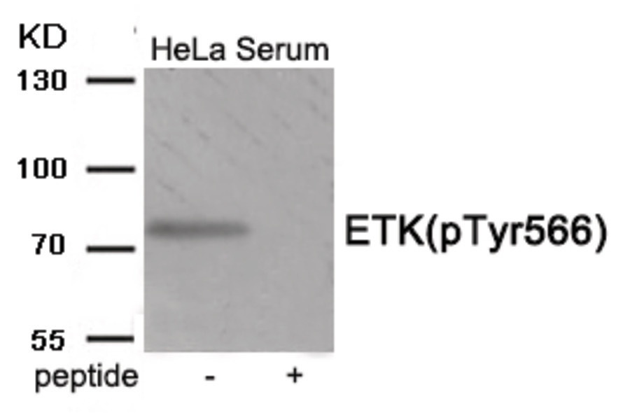 BMX Antibody