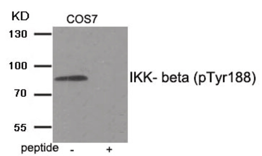 IKBKB Antibody