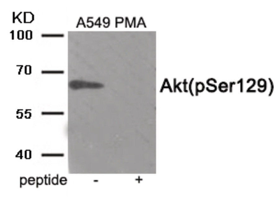 AKT1 Antibody