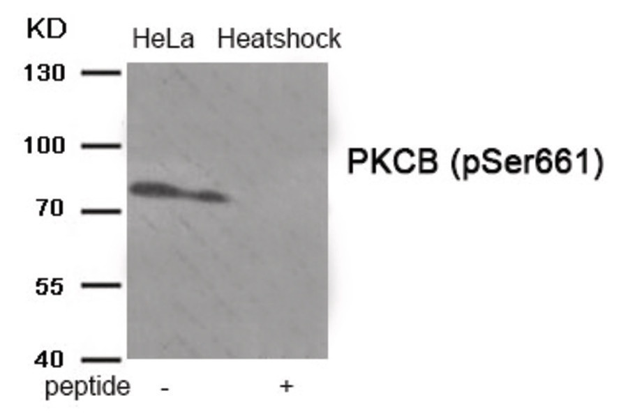 PRKCB Antibody