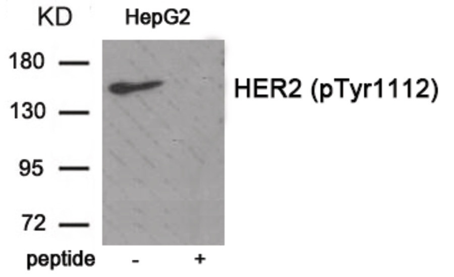 ERBB2 Antibody