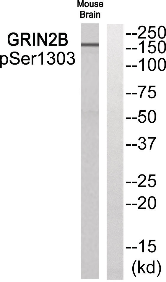 GRIN2B Antibody