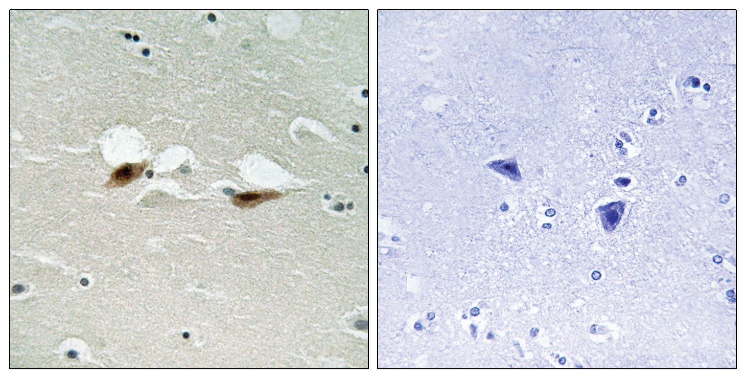 ATF2 Antibody