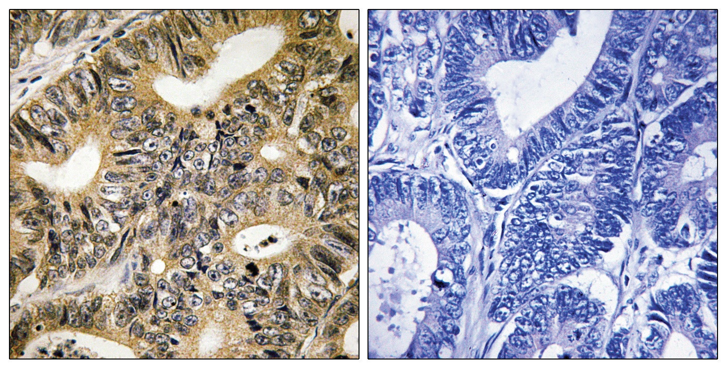 EIF4EBP1 Antibody