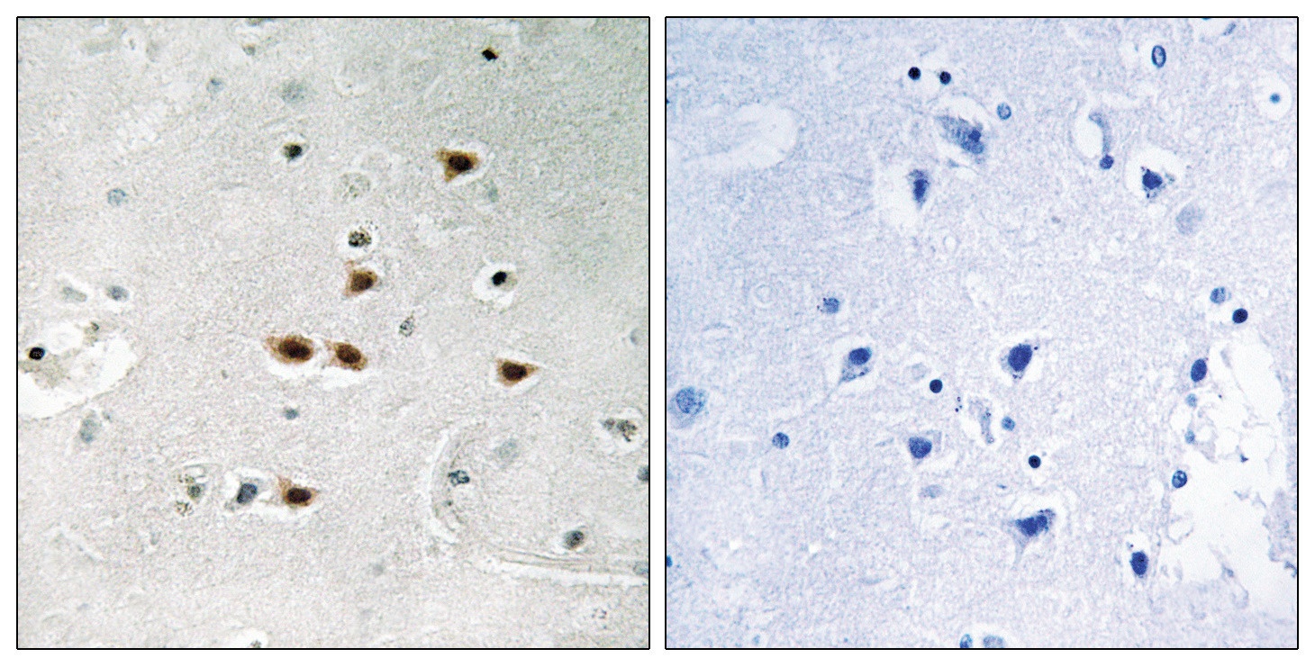 ITCH Antibody