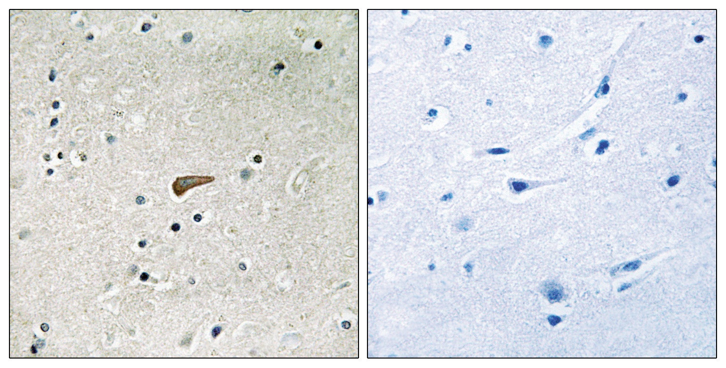 FRS2 Antibody