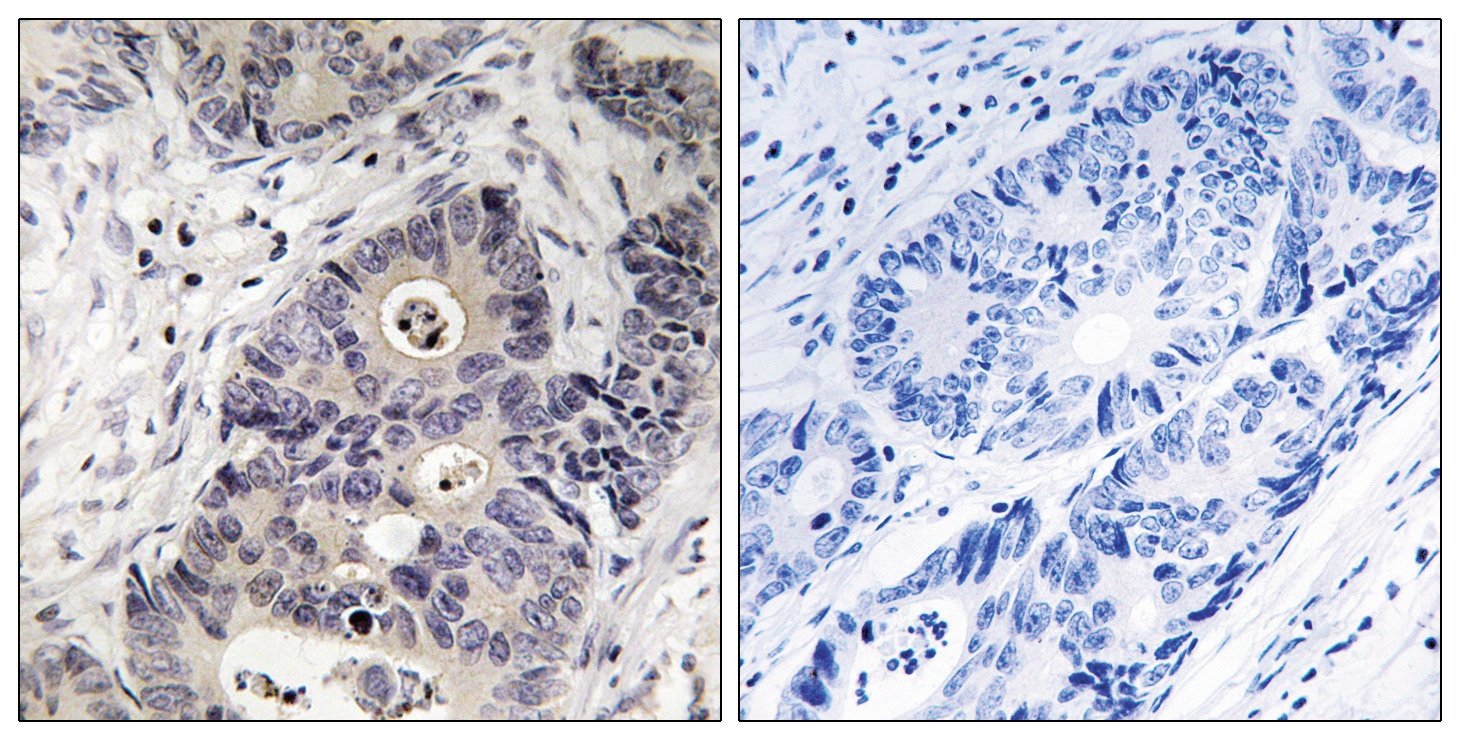 NOS2 Antibody