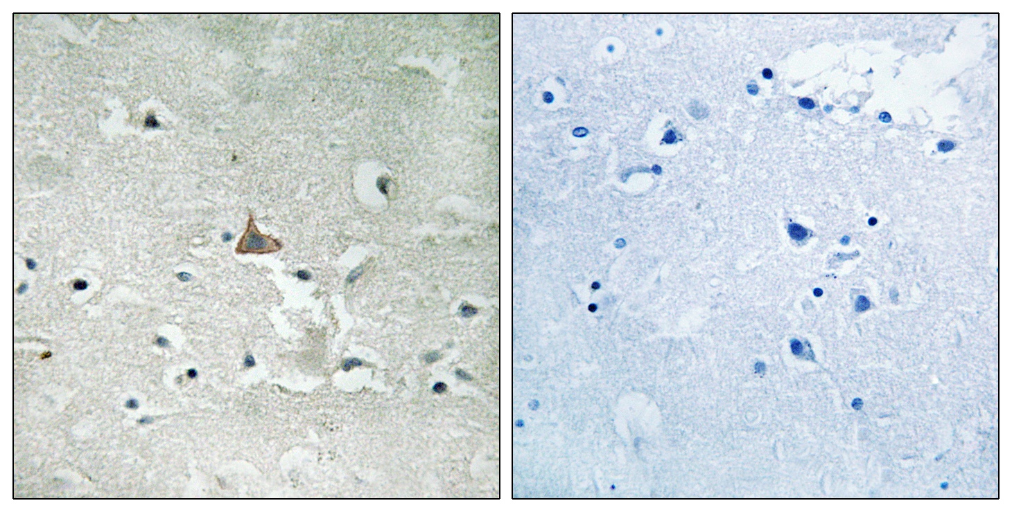 NTRK2 Antibody