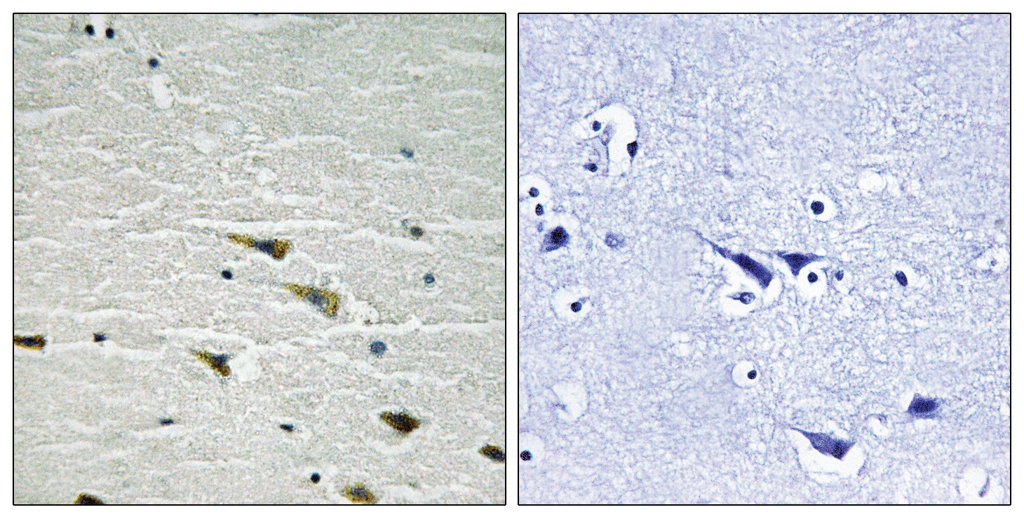 Trk A (phospho Tyr757) Antibody