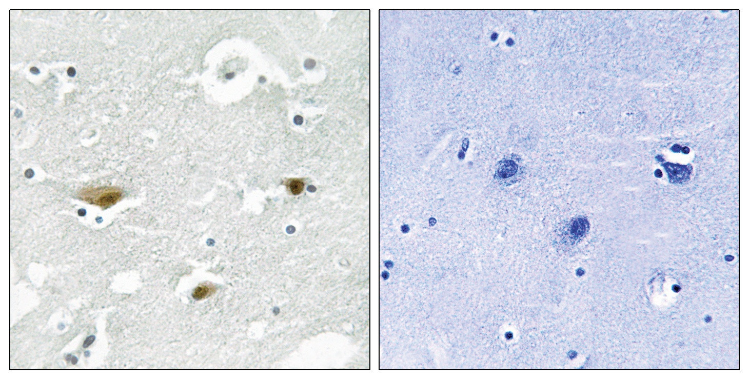 STK39 Antibody