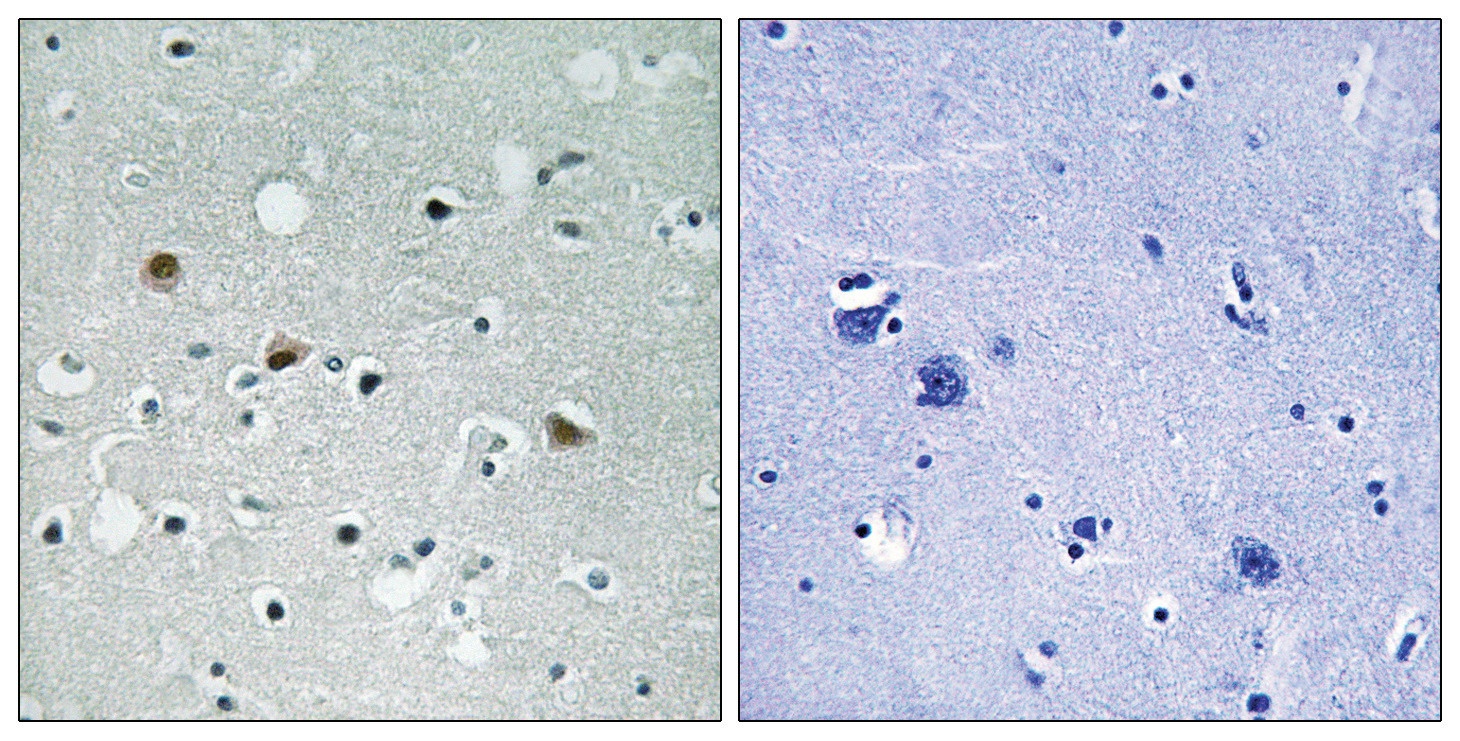 LATS1, LATS2 Antibody