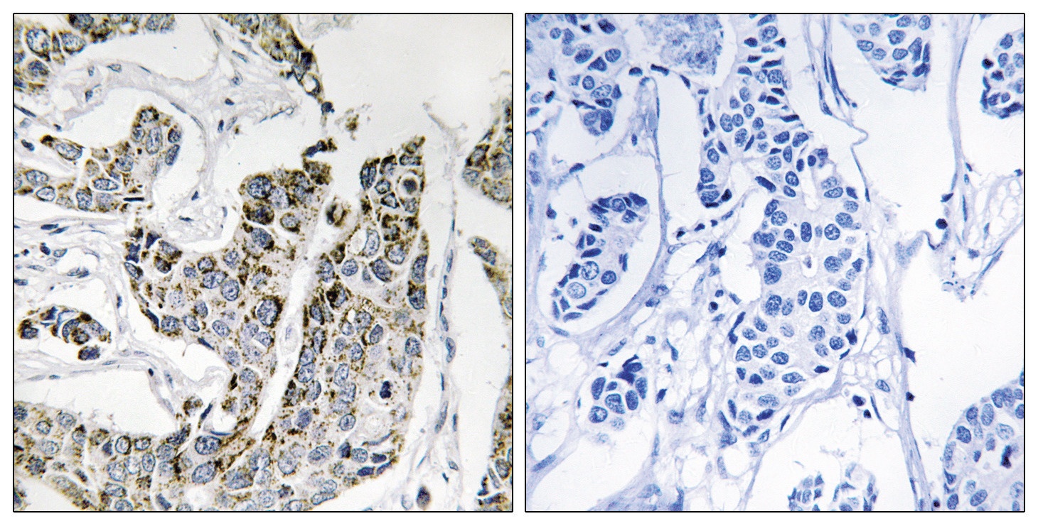 BLK Antibody