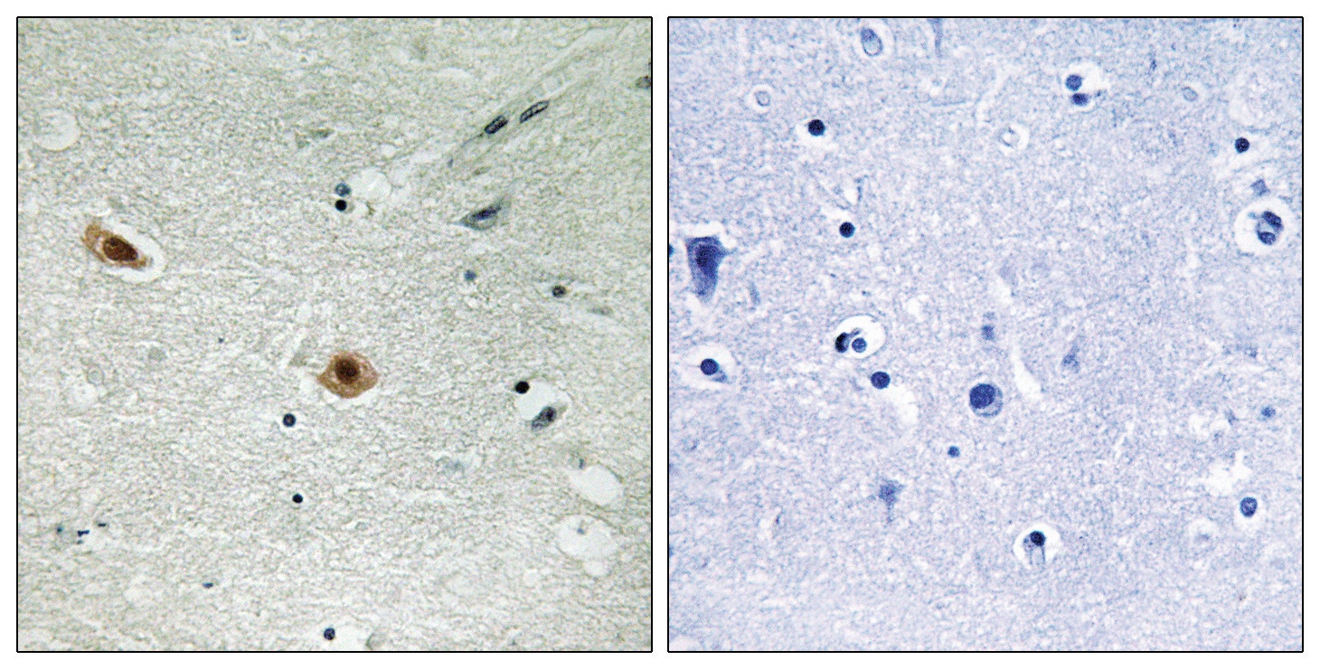 RB1 Antibody