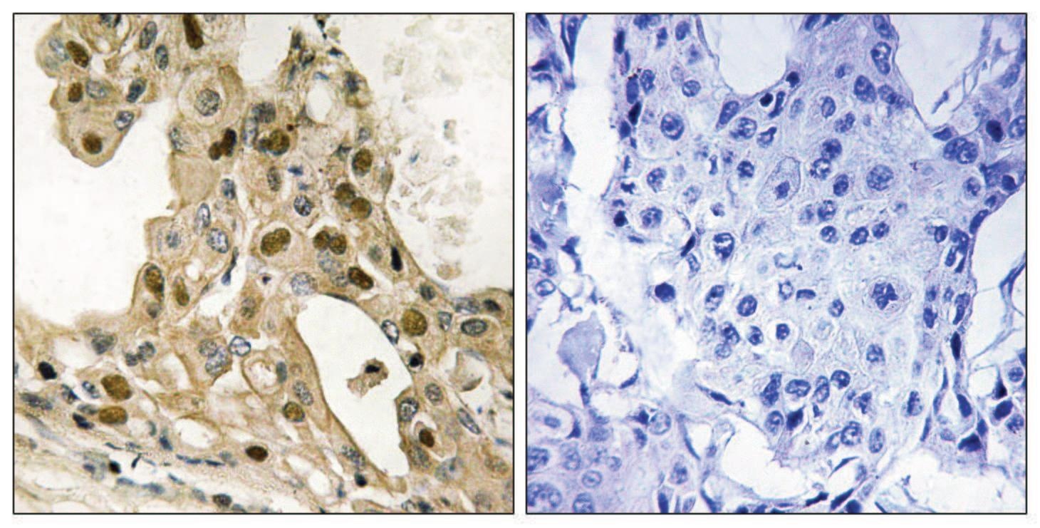 TP53 Antibody
