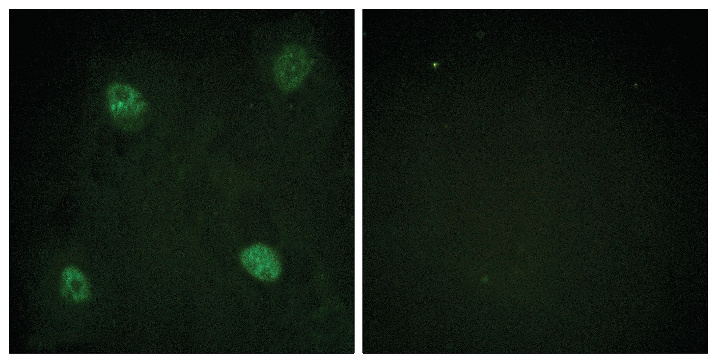 HNRNPD Antibody
