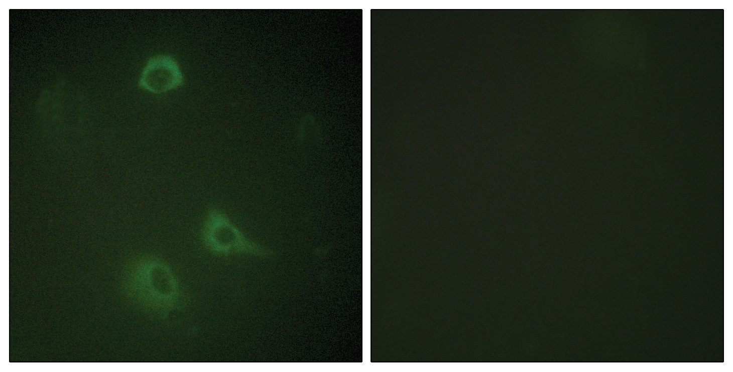 NMDAR1 (phospho Ser890) Antibody