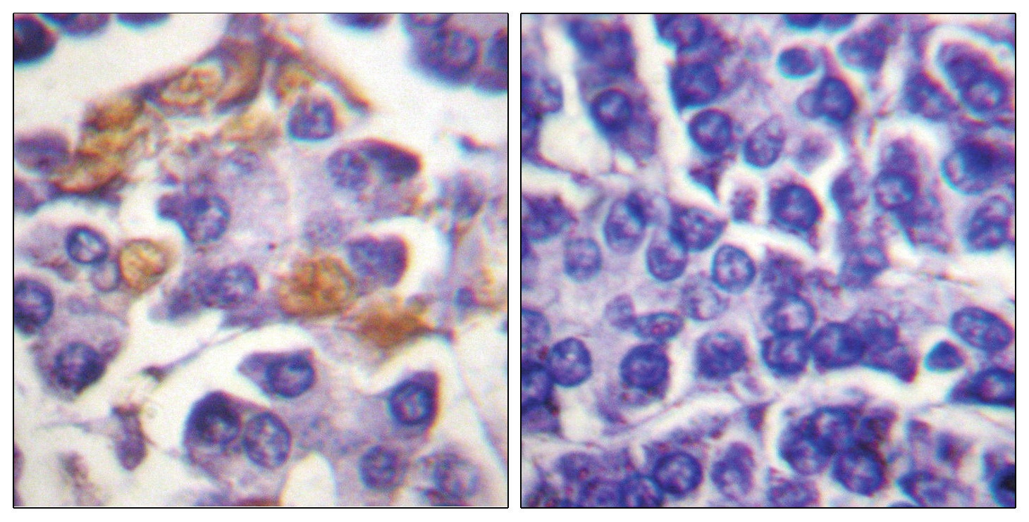 RAF1 Antibody