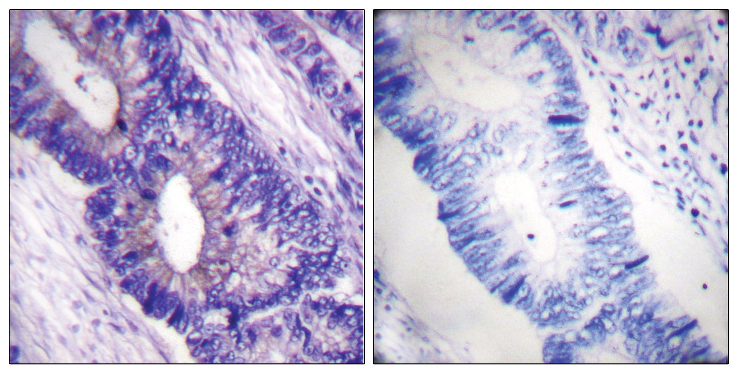 PRKACA Antibody