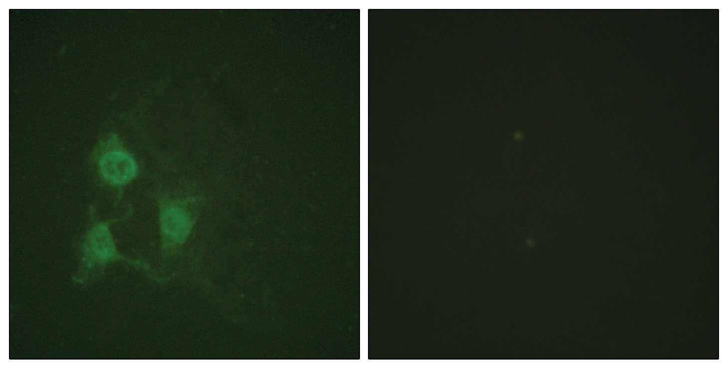 PRKACA Antibody