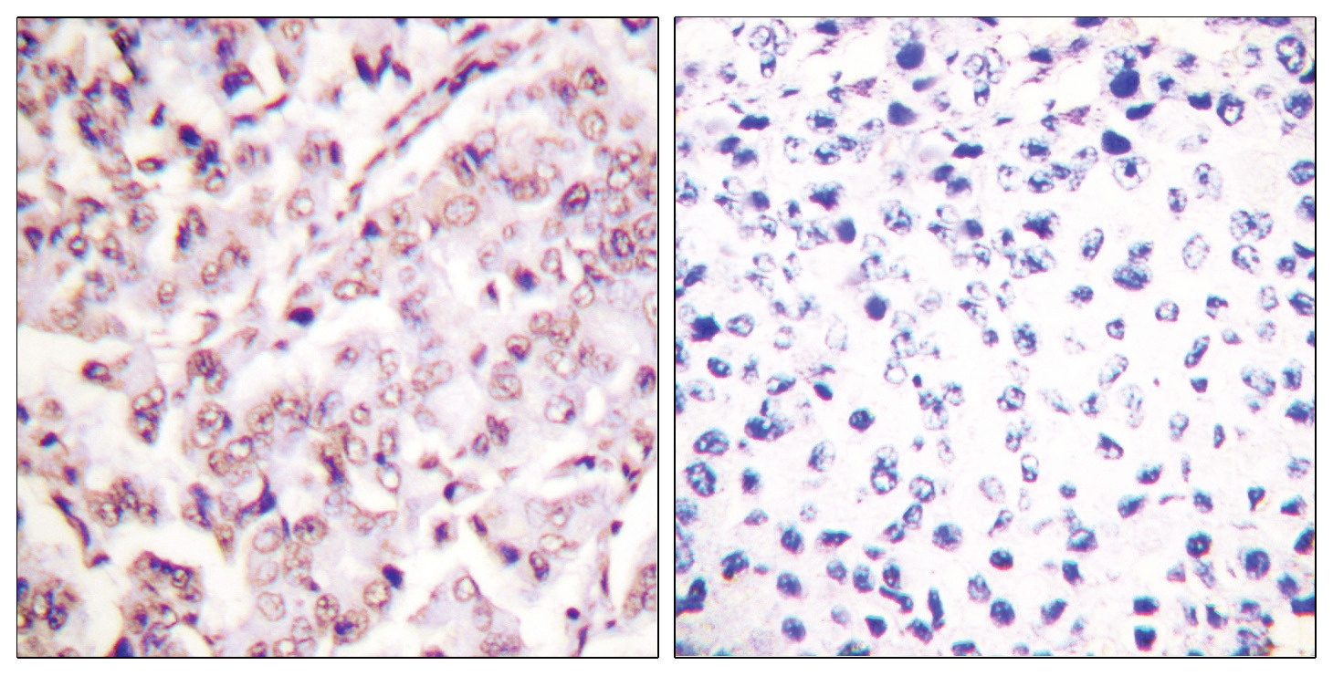ETS1 Antibody