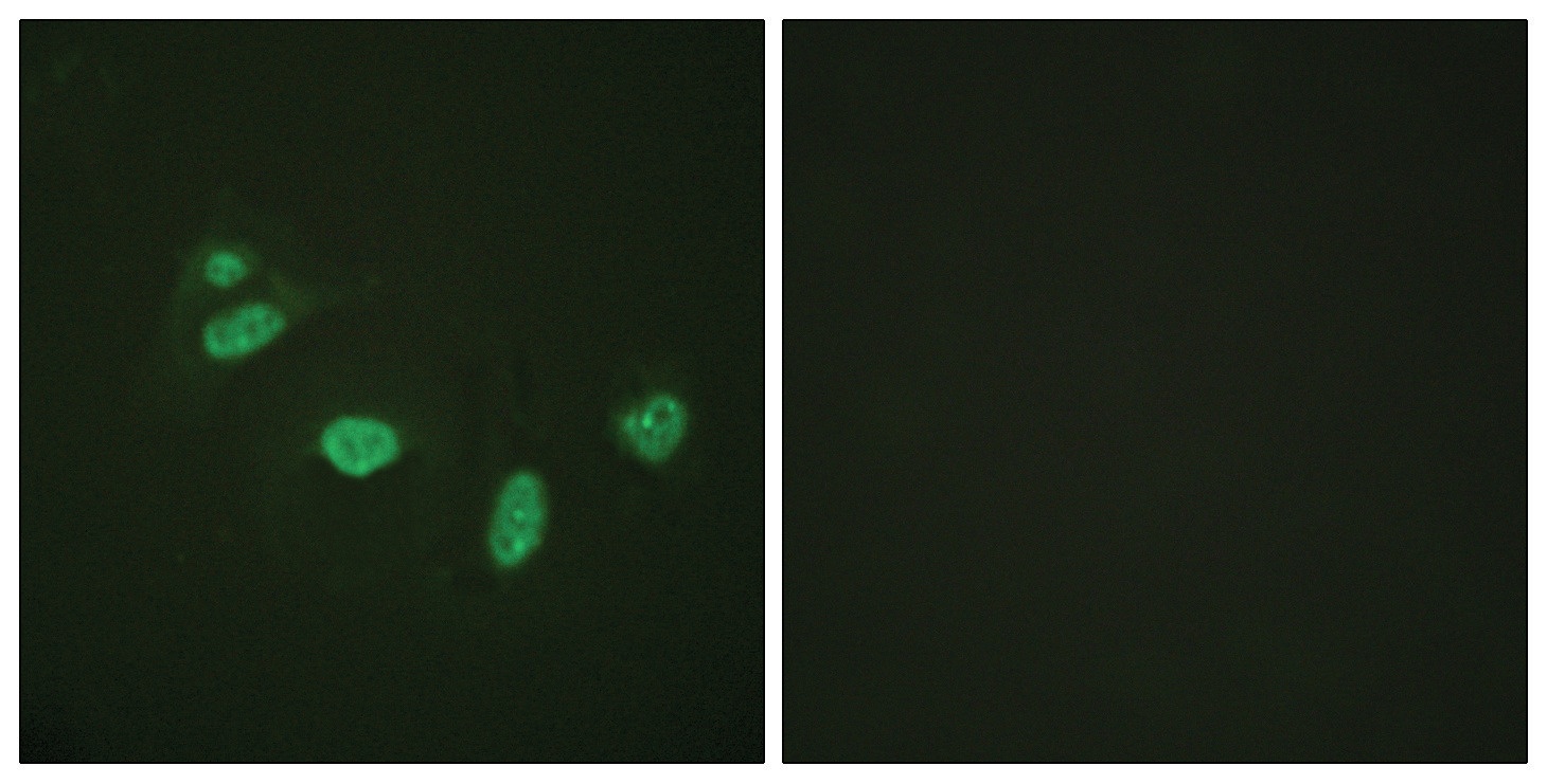 ETS1 Antibody