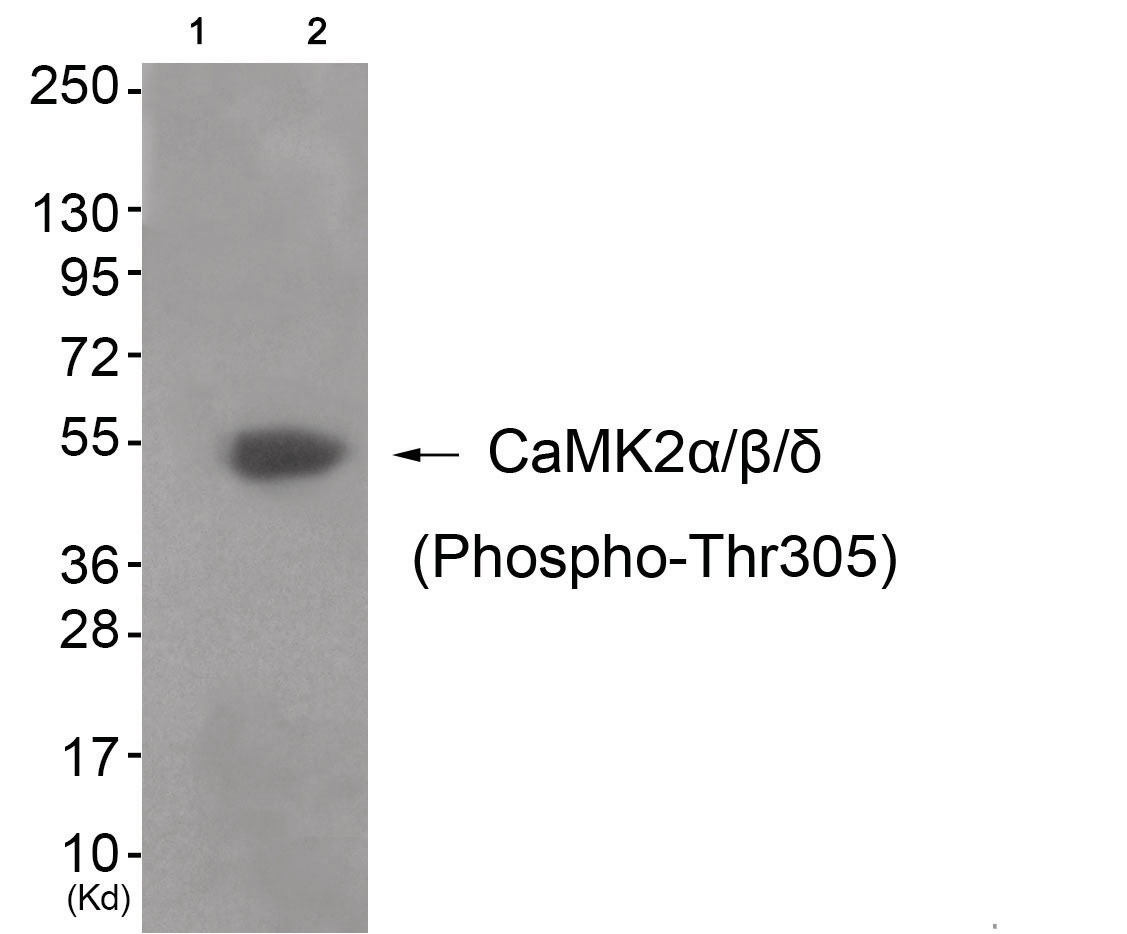 CAMK2B, CAMK2D Antibody