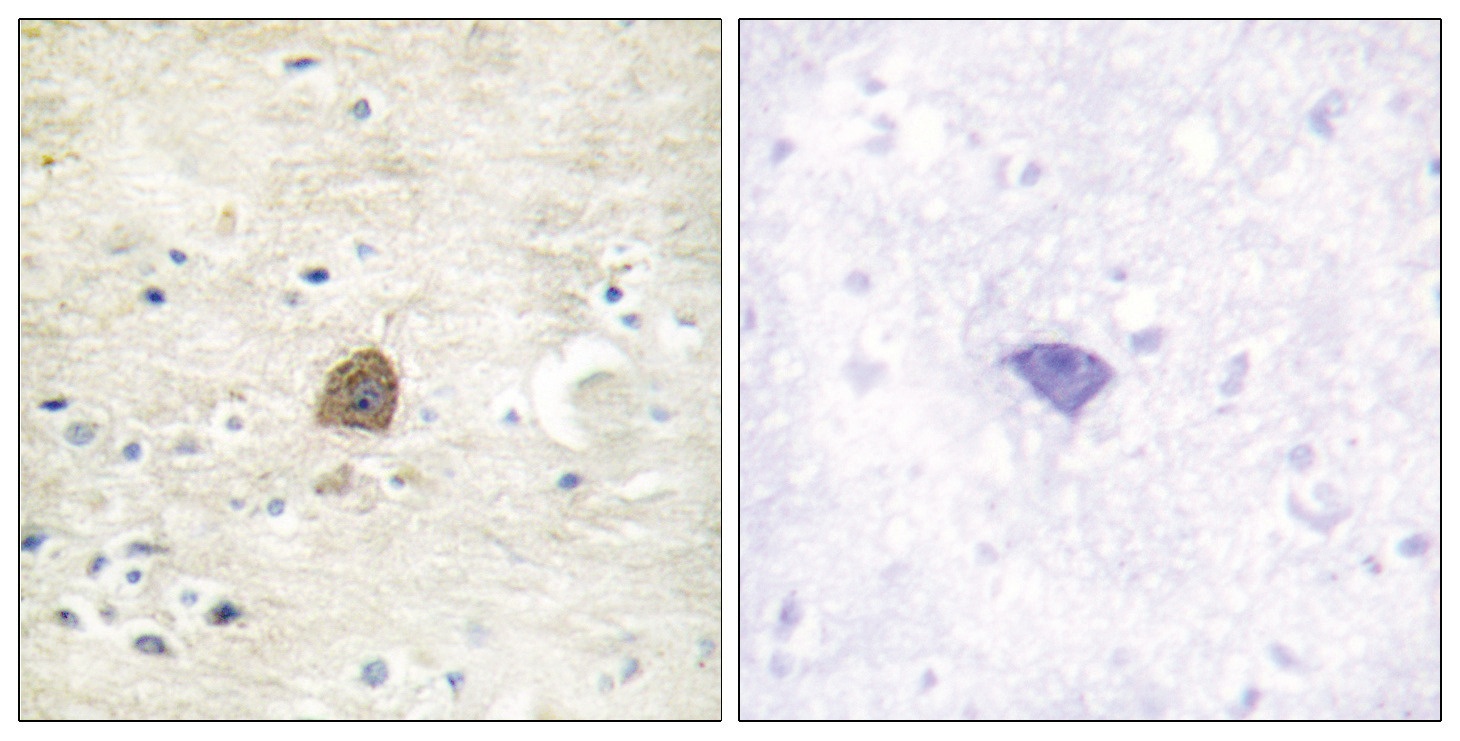 CAMK2B, CAMK2D Antibody