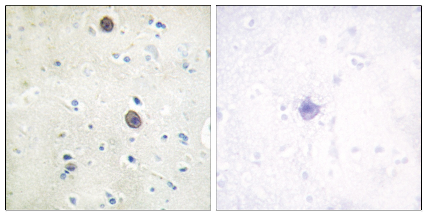 APP Antibody