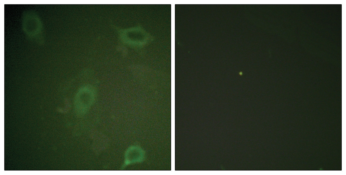 APP Antibody