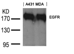 EGFR (Ab 1197) Goat Polyclonal Antibody