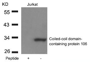 CCDC106 Antibody