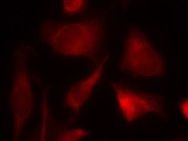 SMAD2 Antibody