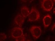SMAD1 Antibody