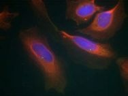 IKBKB Antibody