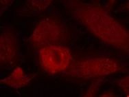 IRS1 Antibody