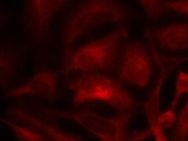 RAC1 Antibody