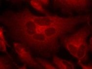 BCR Antibody