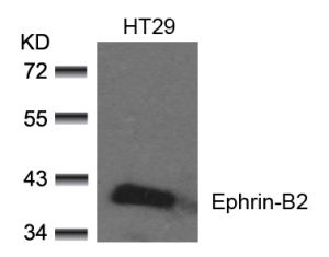 EFNB2 Antibody