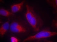 FLT3 Antibody