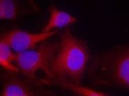 PLCG2 Antibody