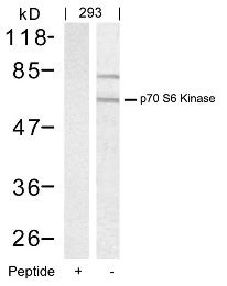 RPS6KB1 Antibody