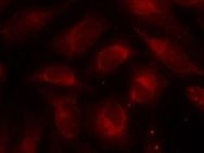 RPS6KB1 Antibody