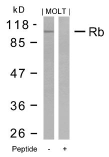 RB1 Antibody