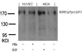EGFR Antibody
