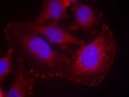 PLCG1 Antibody