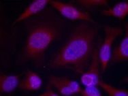 JNK1 / JNK2 (phospho Thr183 / Tyr185) Antibody