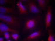 NTRK1 Antibody