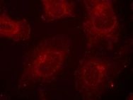 GAB1 Antibody
