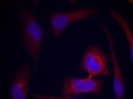 RPS6 Antibody