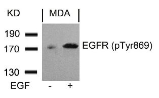 EGFR Antibody